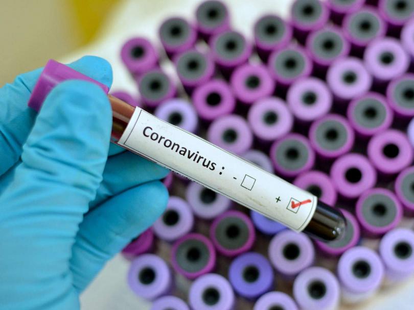 coronavirus bulgaria new cases confirmed total 3290