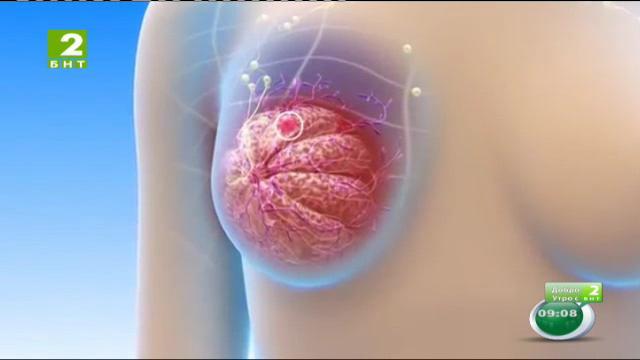 Как да намалим риска от рак на гърдата
