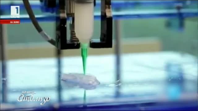 3D принтиране в медицината